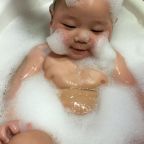 It's not uncommon for babies, who have sensitive skin to have reactions
